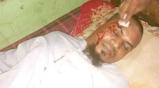 চরফ্যাশনে ‘শাহিন বাহিনী’র নির্যাতনের শিকার দুই জামায়াত নেতা