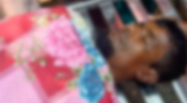 বোরহানউদ্দিনে বিদ্যুস্পৃষ্ট হয়ে অটোরিকশা চালকের মৃত্যু, আহত ২