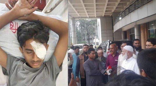 এনসিপির চোখ হারানো আলিফকে দেখতে চক্ষু হাসপাতালে বিরোধীদলীয় নেতা