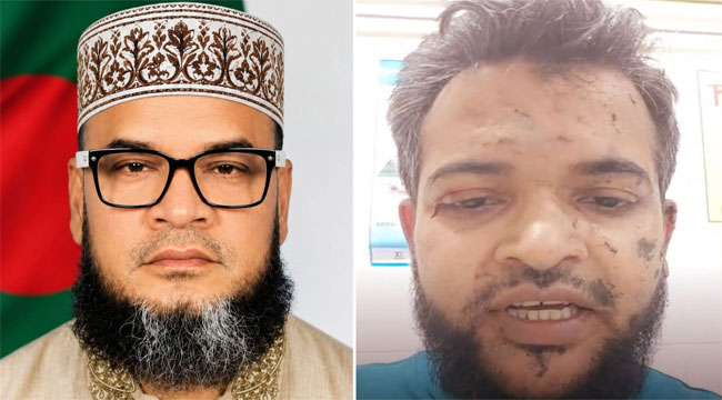 ভাণ্ডারিয়ায় ২ জামায়াত নেতার ওপর যুবদল নেতার নেতৃত্বে হামলা