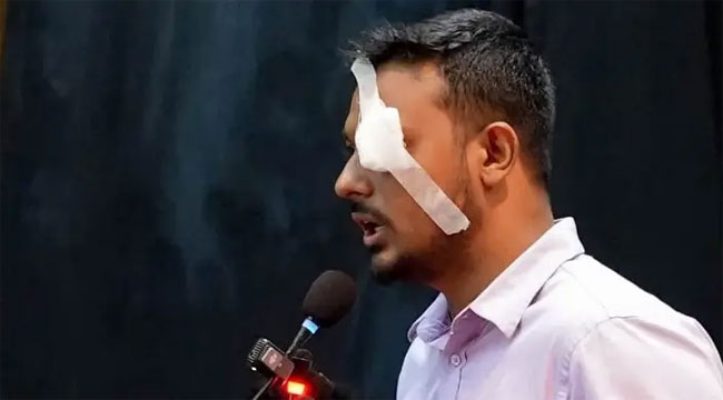 নাসীরুদ্দীন পাটওয়ারীর চোখে ব্যান্ডেজ কেন?