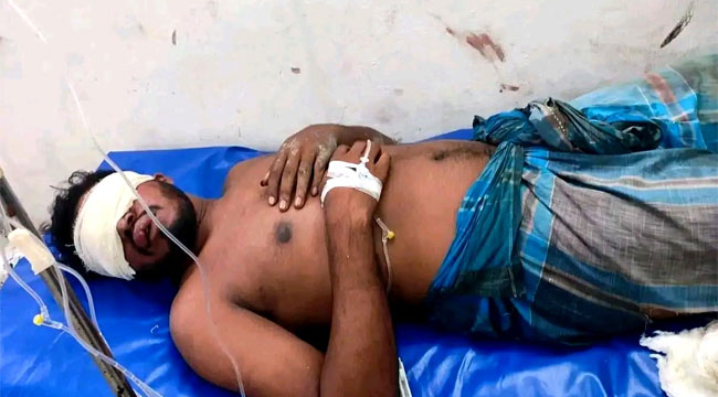 বোরহানউদ্দিনে যুবককে তুলে নিয়ে নির্যাতন, দুই চোখ নষ্টের অভিযোগ; গ্রেপ্তার ১